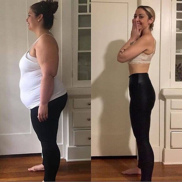 Women before and after abscute